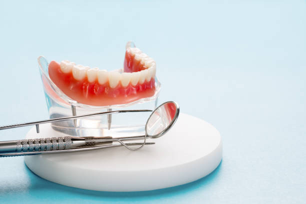 Dental Inlays and Onlays in Orange City, IA